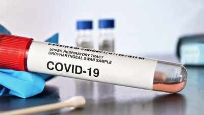 Более 500 пациентов вылечились в Подмосковье от Covid-19 за сутки